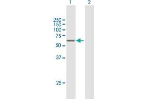 Western Blotting (WB) image for anti-Glutamate Decarboxylase 2 (Pancreatic Islets and Brain, 65kDa) (GAD2) (AA 1-585) antibody (ABIN950143)