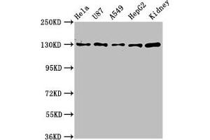 Western Blotting (WB) image for anti-Solute Carrier Family 12 (Potassium-Chloride Transporter) Member 2 (SLC12A2) (AA 110-282) antibody (ABIN7170071)