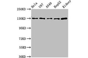 Western Blot Positive WB detected in: Hela whole cell lysate, U87 whole cell lysate, A549 whole cell lysate, HepG2 whole cell lysate, Mouse kidney tissue All lanes: SLC12A2 antibody at 6.