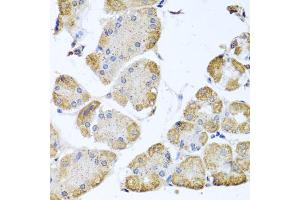Immunohistochemistry of paraffin-embedded human stomach using ITPKB antibody (ABIN5972108) at dilution of 1/100 (40x lens). (ITPKB 抗体)