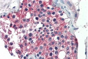 ABIN185587 (5µg/ml) staining of paraffin embedded Human Testis. (ALDH1A1 抗体  (Internal Region))
