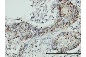 Image no. 1 for anti-RNA Guanine-7 Methyltransferase (RNMT) (AA 1-477) antibody (ABIN599057) (RNMT 抗体  (AA 1-477))