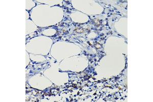 Immunohistochemistry of paraffin-embedded rat lung using iNOS Rabbit pAb  at dilution of 1:100 (40x lens).