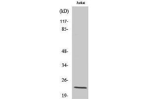 Western Blotting (WB) image for anti-Tumor Protein D52-Like 2 (TPD52L2) (C-Term) antibody (ABIN3174699) (TPD52L2 抗体  (C-Term))