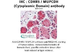 Image no. 2 for anti-Mucin and Cadherin-Like (CDHR5) (Cytoplasmic Domain) antibody (ABIN1732922) (CDHR5 抗体  (Cytoplasmic Domain))