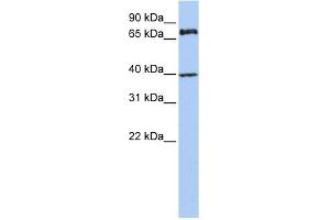 MPP5 antibody used at 1 ug/ml to detect target protein. (MPP5 抗体)