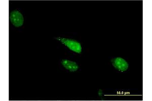 Immunofluorescence of monoclonal antibody to CDC23 on HeLa cell. (CDC23 抗体  (AA 491-591))