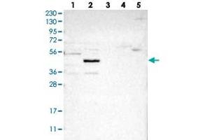 Western blot analysis of Lane 1: RT-4, Lane 2: U-251 MG, Lane 3: Human Plasma, Lane 4: Liver, Lane 5: Tonsil with NSUN5 polyclonal antibody  at 1:250-1:500 dilution. (NSUN5 抗体)