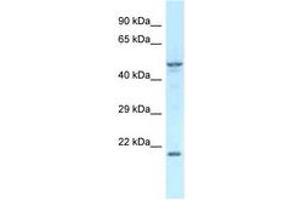 Image no. 1 for anti-Zinc Finger Protein 113 (ZFP113) (AA 200-249) antibody (ABIN6747579) (Zfp113 抗体  (AA 200-249))