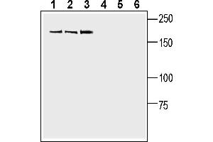 Western blot analysis of human SH-SY5Y neuroblastoma cell line lysate (lanes 1 and 4), human  MG glioblastoma cell line lysate (lanes 2 and 5) and human Jurkat T cell leukemia cell line lysate (lanes 3 and 6):1-3.