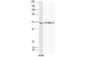 A549 lysate probed with Rabbit Anti-Perilipin 2 Polyclonal Antibody, Unconjugated  at 1:5000 for 90min at 37˚C. (ADRP 抗体  (AA 341-437))