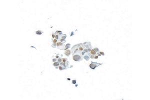 Immunocytochemistry (ICC) image for anti-BRCA1 Associated Protein-1 (Ubiquitin Carboxy-terminal Hydrolase) (BAP1) (AA 475-525) antibody (ABIN7795816) (Recombinant BAP1 抗体  (AA 475-525))