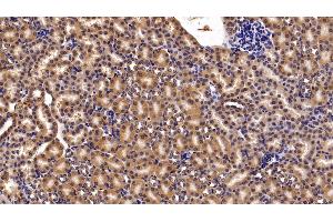 Detection of MGEA5 in Mouse Kidney Tissue using Polyclonal Antibody to Meningioma Expressed Antigen 5 (MGEA5) (MGEA5 抗体  (AA 319-450))