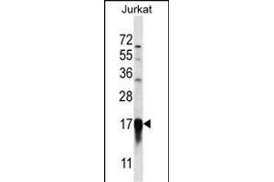 PFDN5 Antibody (Center) (ABIN657046 and ABIN2846213) western blot analysis in Jurkat cell line lysates (35 μg/lane). (PFDN5 抗体  (AA 79-108))