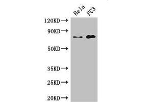 Western Blot Positive WB detected in: Hela whole cell lysate, PC-3 whole cell lysate All lanes: STRBP antibody at 2. (STRBP 抗体  (AA 201-500))