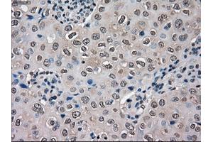 Immunohistochemical staining of paraffin-embedded Ovary tissue using anti-SLC18A2 mouse monoclonal antibody. (SLC18A2 抗体)
