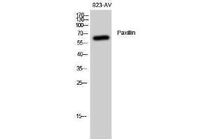 Western Blotting (WB) image for anti-Paxillin (PXN) (Thr508) antibody (ABIN3186344) (Paxillin 抗体  (Thr508))