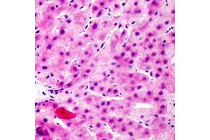 Immunohistochemistry (IHC) image for anti-Fibroblast Growth Factor Receptor Substrate 2 (FRS2) (C-Term), (pTyr436) antibody (ABIN7300704)