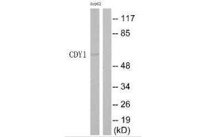 Western blot analysis of extracts from HepG2 cells, using CDY1 antibody. (CDY1 抗体)