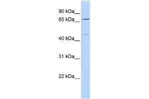 WB Suggested Anti-KLHL15 Antibody Titration: 0.