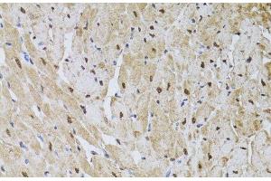 Immunohistochemistry of paraffin-embedded Rat heart using HUS1 Polyclonal Antibody at dilution of 1:100 (40x lens). (HUS1 抗体)