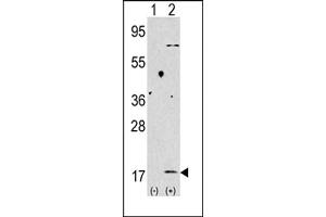 Western blot analysis of anti-LC3 (G8b) Pab 1802b in 293 cell line lysates transiently transfected with the LC3 (G8b) gene (2 μg/lane).