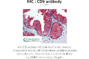 Image no. 1 for anti-CD9 (CD9) antibody (ABIN1723299) (CD9 抗体)