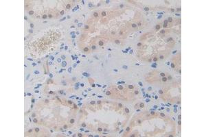 IHC-P analysis of Human Tissue, with DAB staining. (GTF2A1 抗体  (AA 2-274))
