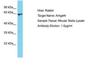 Image no. 1 for anti-rho Guanine Nucleotide Exchange Factor (GEF) 4 (ARHGEF4) (AA 51-100) antibody (ABIN6750412) (ARHGEF4 抗体  (AA 51-100))