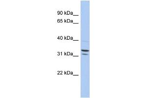 WB Suggested Anti-FAM92B Antibody Titration: 0. (FAM92B 抗体  (N-Term))