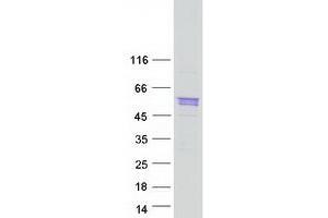 Sarcalumenin Protein (SRL) (Myc-DYKDDDDK Tag)