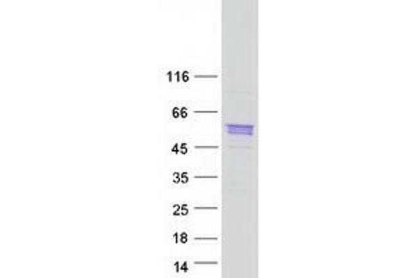 Sarcalumenin Protein (SRL) (Myc-DYKDDDDK Tag)