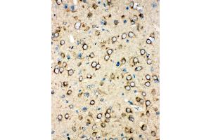 Anti-MTCO1 antibody,  IHC(P) IHC(P): Rat Brain Tissue (COX1 抗体  (N-Term))