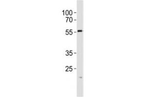 Western blot analysis of lysate from A431 cell line using SPHK1 antibody at 1:1000. (SPHK1 抗体  (AA 1-30))