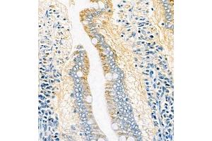 Immunohistochemistry (Paraffin-embedded Sections) (IHC (p)) image for anti-ATPase, Ca++ Transporting, Plasma Membrane 1 (ATP2B1) antibody (ABIN7073155)