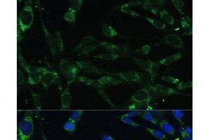 Immunofluorescence analysis of NIH-3T3 cells using CAPN5 Polyclonal Antibody at dilution of 1:100. (Calpain 5 抗体)