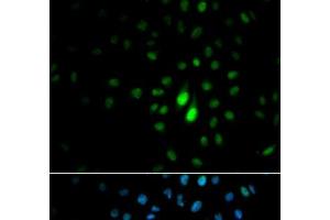 Immunofluorescence analysis of MCF-7 cells using PIN1 Polyclonal Antibody (PIN1 抗体)