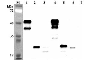 Western blot analysis using anti-FGF-21 (human), mAb (FG224-7)  at 1:2'000 dilution. (FGF21 抗体)