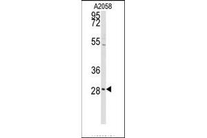 Image no. 1 for anti-Protein Kinase C, delta Binding Protein (PRKCDBP) (Middle Region) antibody (ABIN360096)