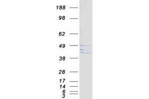 Validation with Western Blot (CECR5 Protein (Transcript Variant 2) (Myc-DYKDDDDK Tag))
