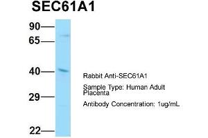 Host: Rabbit  Target Name: SEC61A1  Sample Tissue: Human Adult Placenta  Antibody Dilution: 1. (SEC61A1 抗体  (C-Term))