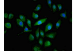 Immunofluorescent analysis of A549 cells using ABIN7146640 at dilution of 1:100 and Alexa Fluor 488-congugated AffiniPure Goat Anti-Rabbit IgG(H+L) (ABCC3 抗体  (AA 827-953))