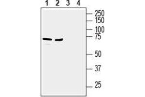 Western Blotting (WB) image for anti-Solute Carrier Family 39 (Zinc Transporter), Member 6 (SLC39A6) (AA 251-264), (Extracellular) antibody (ABIN7043725)