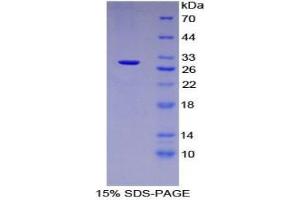 SDS-PAGE analysis of Mouse Tubulin beta 6 Protein. (TUBb6 蛋白)