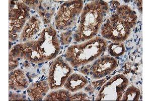 Immunohistochemical staining of paraffin-embedded Human Kidney tissue using anti-PRKAR2A mouse monoclonal antibody. (PRKAR2A 抗体)
