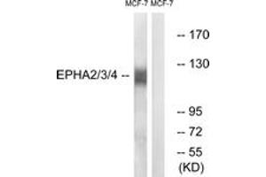Western blot analysis of extracts from MCF-7 cells, using EPHA2/3/4 (Ab-588/596) Antibody. (EPHA2/3/4 抗体  (AA 556-605))