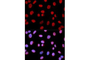 Immunofluorescence (IF) image for anti-Minichromosome Maintenance Complex Component 6 (MCM6) (AA 562-821) antibody (ABIN3022687) (MCM6 抗体  (AA 562-821))