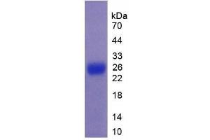 SDS-PAGE analysis of Mouse Mucin 5B Protein. (MUC5B 蛋白)