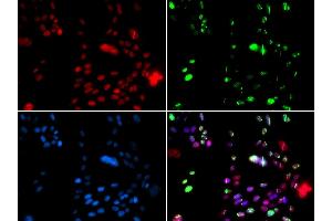 Immunofluorescence analysis of GFP-RNF168 transgenic U2OS cells using PI antibody (ABIN6128449, ABIN6145593, ABIN6145595 and ABIN6221396). (PIAS1 抗体  (AA 422-651))