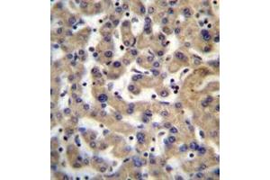 Immunohistochemistry analysis in formalin fixed and paraffin embedded human liver tissue reacted with PDP1 Antibody (Center) followed by peroxidase conjugation of the secondary antibody and DAB staining. (PDP 抗体  (Middle Region))
